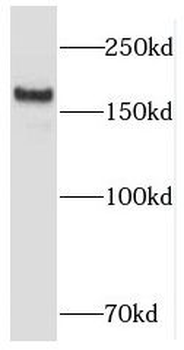 RB1CC1 Rabbit Polyclonal Antibody