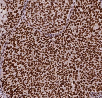 RBBP4 Rabbit Polyclonal Antibody