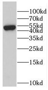RBBP4 Rabbit Polyclonal Antibody