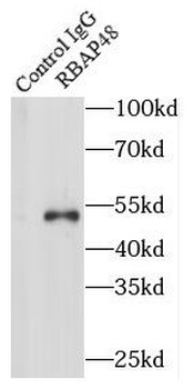 RBBP4 Rabbit Polyclonal Antibody