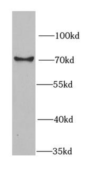 RBBP5 Rabbit Polyclonal Antibody