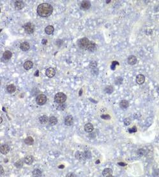 RBBP5 Rabbit Polyclonal Antibody