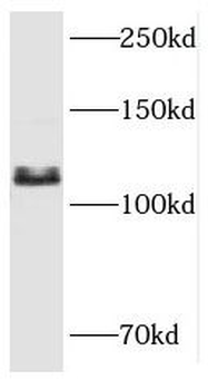 RBBP8 Antibody