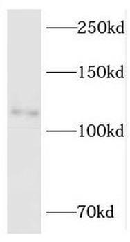 RBM10 Rabbit Polyclonal Antibody