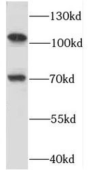 RBM15B Antibody