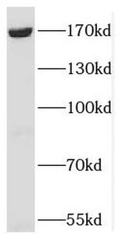 SCAF8 Rabbit Polyclonal Antibody