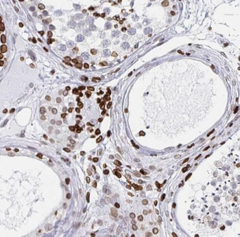 SCAF8 Rabbit Polyclonal Antibody