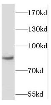 RBM28 Rabbit Polyclonal Antibody