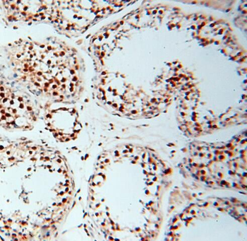 RBM3 Rabbit Polyclonal Antibody