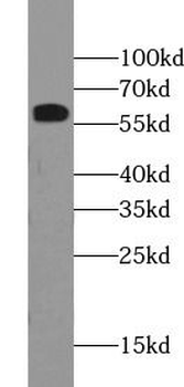 RBM39 Rabbit Polyclonal Antibody