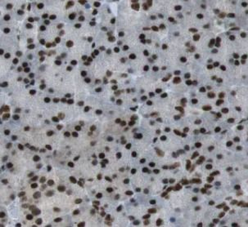 RBM39 Rabbit Polyclonal Antibody