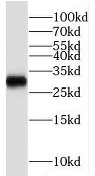 RBMX2 Rabbit Polyclonal Antibody