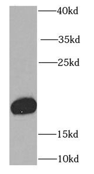 RBP4 Rabbit Polyclonal Antibody