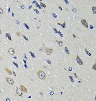 RBP4 Rabbit Polyclonal Antibody