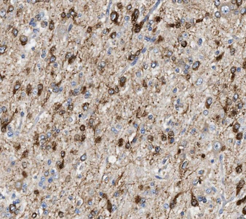 RCAN2 Rabbit Polyclonal Antibody