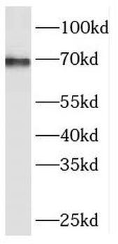 RCOR3 Rabbit Polyclonal Antibody