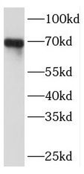 RCOR3 Rabbit Polyclonal Antibody