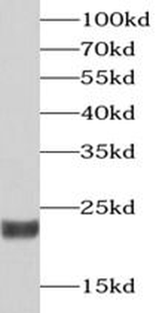 RCVRN Rabbit Polyclonal Antibody
