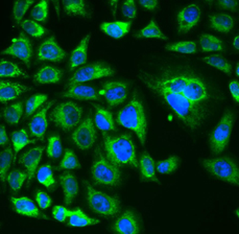 RCVRN Rabbit Polyclonal Antibody