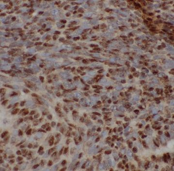 RCVRN Rabbit Polyclonal Antibody