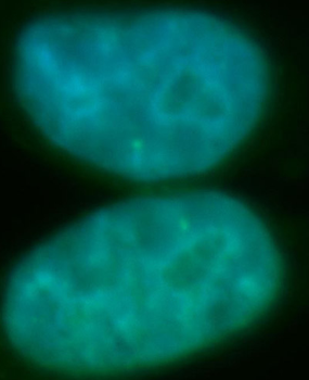 RECQL5 Rabbit Polyclonal Antibody