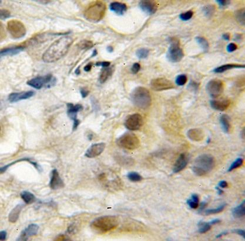 RECQL5 Rabbit Polyclonal Antibody