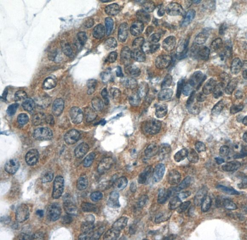 RELB Rabbit Polyclonal Antibody