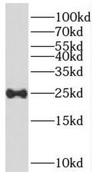 RERG Rabbit Polyclonal Antibody