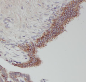 RERG Rabbit Polyclonal Antibody