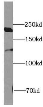 REST Rabbit Polyclonal Antibody