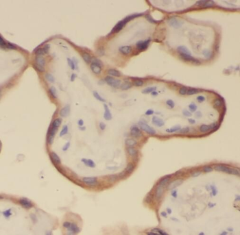 REXO2 Rabbit Polyclonal Antibody