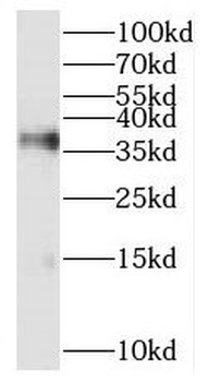 RFC2 Rabbit Polyclonal Antibody