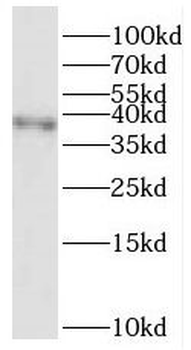 RFC3 Rabbit Polyclonal Antibody
