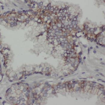 RGR Rabbit Polyclonal Antibody