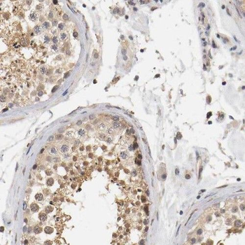 RGS17 Rabbit Polyclonal Antibody