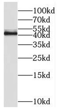 RGS5 Rabbit Polyclonal Antibody