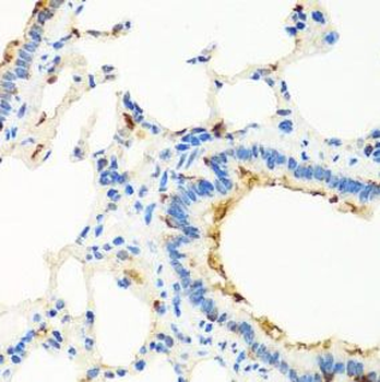 RGS5 Rabbit Polyclonal Antibody