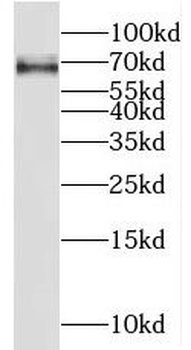 RGS7 Rabbit Polyclonal Antibody
