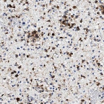 RGS7 Rabbit Polyclonal Antibody