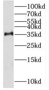 RHBDD1 Rabbit Polyclonal Antibody