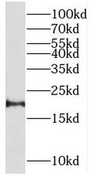 RHEB Rabbit Polyclonal Antibody