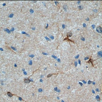 RHEB Rabbit Polyclonal Antibody