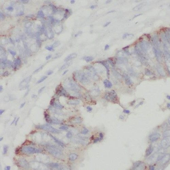 RHOF Rabbit Polyclonal Antibody