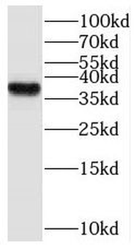 RHOXF2 Rabbit Polyclonal Antibody