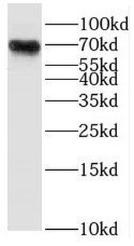 RHPN1 Rabbit Polyclonal Antibody