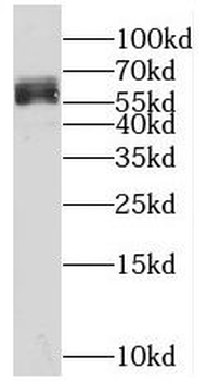RIC8A Rabbit Polyclonal Antibody