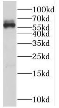 RIC8A Rabbit Polyclonal Antibody