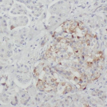 RIC8A Rabbit Polyclonal Antibody