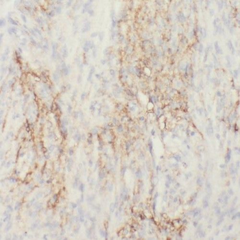 RIC8B Rabbit Polyclonal Antibody