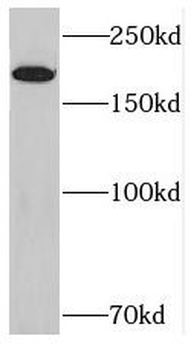 RICTOR Rabbit Polyclonal Antibody